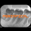 Periapical
